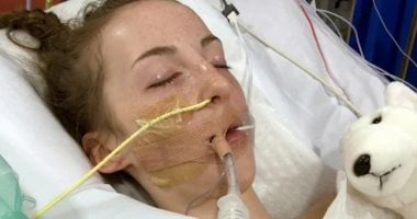 وفاة فتاة بمرض نادر يحدث لواحد فى المليون بسبب عدوى الغشاء المخاطى.. صور