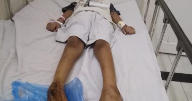 "كعب داير على المستشفيات".. مأساة طفل عمره 8 سنوات فقد القدرة على الحركة والسمع.. مدير التأمين الصحى بالأسكندرية: تشكيل لجنة طبية على أعلى مستوى لفحص حالته.. وتقديم كافة الخدمات العلاجية للطفل حتى يتم شفاؤه