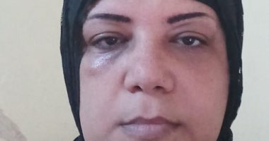 مأساة سيدة مريضة بالسرطان.. طلقها زوجها ومهددة بالطرد من الشقة بسبب الإيجار