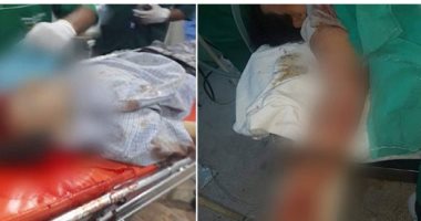 تليفزيون سوريا: مقتل 5 أشخاص وجرح 9 فى رأس العين نتيجة العدوان التركى