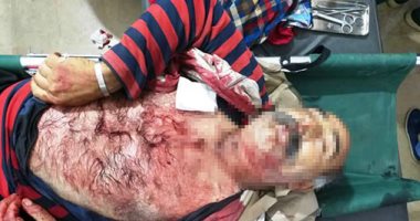 استشهاد سورى وإصابة 3 آخرين فى قصف مدفعى تركى على قرية الدرباسية