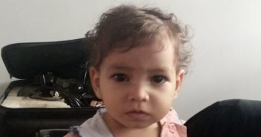 فريق طبي ينجح باجراء عملية إصلاح للحول بالعينين لطفله لاول مرة بمستشفى اتميدة بالدقهلية 