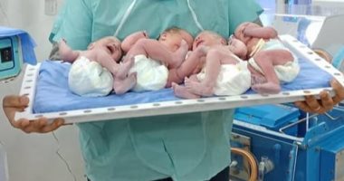 صور.. سيدة تضع 4 ذكور توائم فى الغربية 