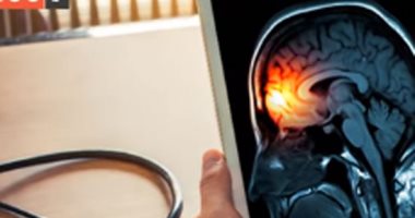 فيديو معلوماتى.. 7 خطوات للوقاية من الالتهاب السحائى