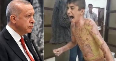 إدانة دولية واسعة لأسلحة أردوغان الكيماوية..الأمم المتحدة تحقق والبرلمان الأوروبى يدعو لمحاسبة فورية لأنقرة على استخدام الفسفور الأبيض والنابالم الحارق..والإدارة الكردية:الهجمات سببت تشوهات للأطفال وتنذر بكارثة