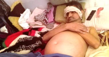 بائع متجول يعانى من تليف الكبد.. وكل ما يتمناه العلاج على نفقة الدولة