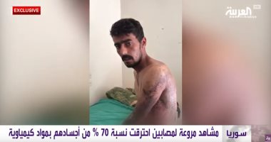 فيديو يؤكد استخدام العدوان التركى على سوريا أسلحة محرمة دوليا