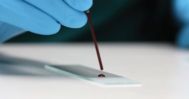  اطمن على نفسك.. متى يطلب الطبيب منك إجراء مسحة الدم؟