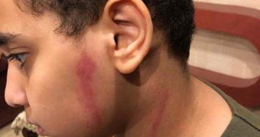 قارئ يشكو من تعرض نجله للضرب على يد مدرس بمدرسة خاصة فى الزيتون