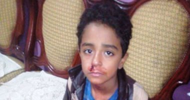 ولية أمر تلميذ تشكو مدرس صفع نجلها وتسبب له فى نزيف بالأنف وتبوله على نفسه
