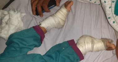 تضامن الشرقية تكشف تفاصيل تعذيب طفلة بأبوحماد و تقرر صرف معاش لها