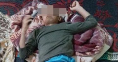 شاهد أول صور لطفل المنوفية المعتدى عليه بـ"أنبوبة"