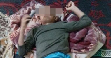 حبس المتهم بإلقاء إسطوانة غاز على طفل فى المنوفية 4 أيام على ذمة التحقيقات