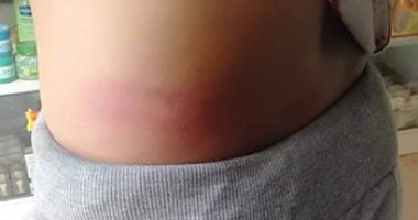 تفاصيل ضرب مدرس لطالب بالخرطوم بالخصوص.. والتعليم تحيله للشئون القانونية