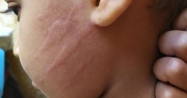 "تعليم سوهاج" تستبعد مدرسا صفع تلميذا بالمرحلة الإبتدائية على وجهه.. صور