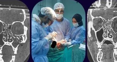 مستشفى الأقصر العام تجرى جراحة لإصلاح كسر متفتت بالوجه لمواطن