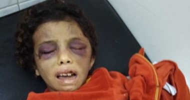 نيابة بلبيس تطلب تقريرا مفصلا عن حالة الطفلة هبة ضحية تعذيب خالتها