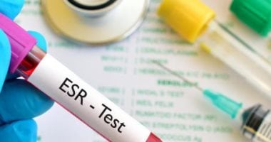 اطمن على نفسك.. لماذا يطلب الطبيب تحليل "ESR"
