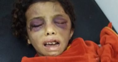 نيابة الشرقية تأمر بإخراج والدة الطفلة المعذبة من محبسها لسماع أقوالها