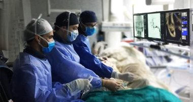 إجراء أول حالة سحب جلطة دماغية باستخدام القسطرة التداخلية بجامعة الزقازيق