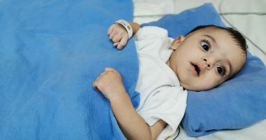 صور.. خروج التوأم السيامى الليبى من العناية المركزة بالسعودية