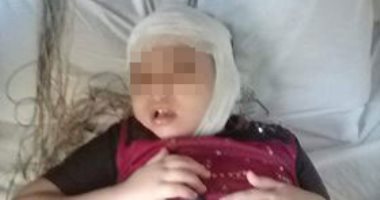 قارئ يستغيث عبر "صحافة المواطن" لإجراء عملية جراحية دقيقة لـ"ابنته"