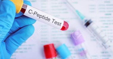 اتطمن على نفسك.. واعرف أسباب طلب الطبيب لتحليل C-peptide