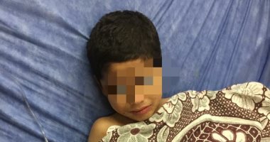 فريق طبى بمستشفى سوهاج الجامعى ينقذ حياة طفل بعد سقوطه من الطابق الرابع