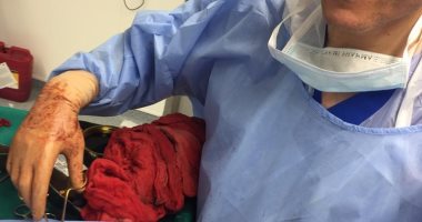 استئصال ورم نادر يزن 1680 جراما من رحم سيدة بمستشفى كفر الشيخ الجامعى