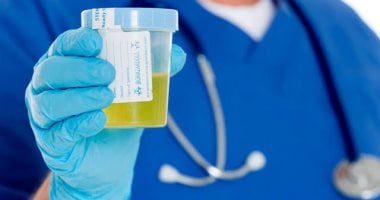 اطمن على نفسك.. لماذا يطلب الطبيب اختبار الجلوكوز في البول؟