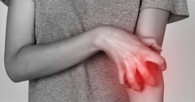 تنسيقية الأطباء والبيطريين باسطنبول تحذر من انتشار  "الجرب" بتركيا