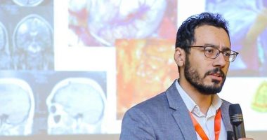 نجاح استئصال بؤرة صرعية بالمخ والمريضة مستيقظة بجامعة الزقازيق