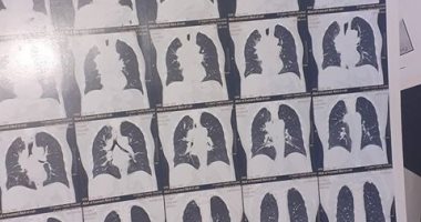 قارىء يطلب نقل والده إلى مستشفى متخصصة بالأورام فى بنى سويف