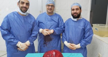 استئصال ورم يزن 5 كيلو بالكلى اليسرى لمريضه بمركز أورام طنطا