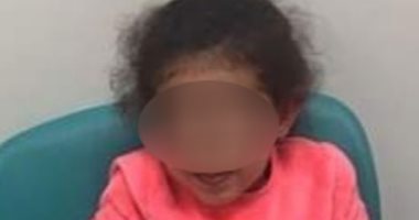 الإهمال ينهى طفولة عايدة بكسر عظامها فى نادى سبورتنج.. صور