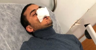 "قنوات الإخوان المنافقة".. أبواق الجماعة تتجاهل جريمة عنصرية ضد مواطن مصرى فى إسطنبول خوفا من إغضاب أردوغان.. وإعلام المعارضة التركية يبرز القصة.. والشاب يؤكد: الاستعلاء على الأجانب فى تركيا بقى حاجة تقرف