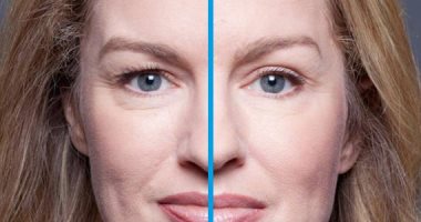 سمعتى عن الـ Eye Lift؟.. اعرفى أنواعه ونصائح تغنيكِ عن عمليات التجميل