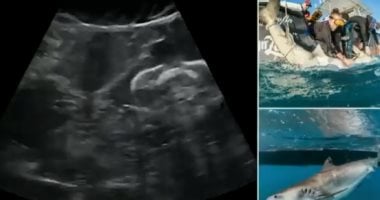 مشهد من الخيال.. 5 أسماك قرش تسبح داخل أرحام أمهاتها بالموجات فوق الصوتية