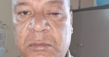 بعد استئصال عينه اليسرى.. "محمود" يناشد تسليمه فيزا معاش تكافل وكرامة