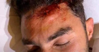 الأهلي يفحص فتحي وياسر إبراهيم.. وبرنامج خاص لمواجهة بيراميدز