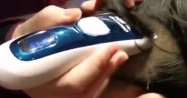 ممرضات الصين يحلقن شعرهن لمنع انتشار "كورونا".. فيديو