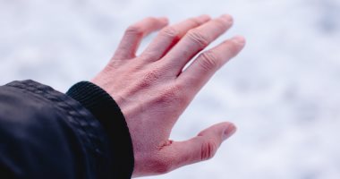 لسعة البرد أو عضة الصقيع.. مرض يصيب أطرافك فى الشتاء