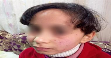 فى مدارس كفر الشيخ.. "الاخصائية النفسية بتدمر النفسية".. تعرف على مأساة الطفلة رقية