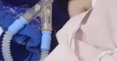 "حمزة" مصاب بضمور شوكى ويحتاج إلى علاج بالخارج ووالده: حالته حرجة