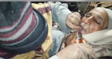 أحسن من الدكتور.. رجل يخلع ضرس صديقه بـ"الكماشة" 