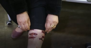 ضبط طالب أطلق كلب عقر شخص زوجته لخلافات جيرة بينهم بالزاوية الحمراء 
