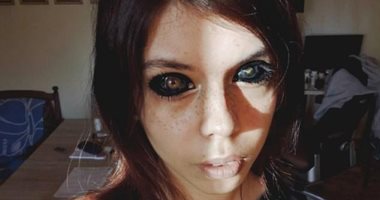 بولندية تفقد بصرها للأبد بعد رسم وشم "داخل عينها".. صور