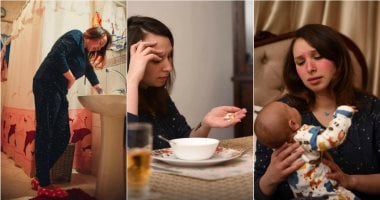 قصة مرض فى 10 صور.. "سيشن" يصور رحلة معاناة مرضى الذئبة الحمراء