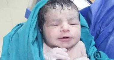 صور.. نجاح حالتي ولادة فجرا لسيدتين مصابتين بكورونا   