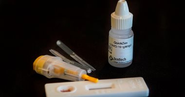 شركة بلجيكية تطور تكنولوجيا لاختبار الأجسام المضادة بدقة 100٪ .. اعرف التفاصيل